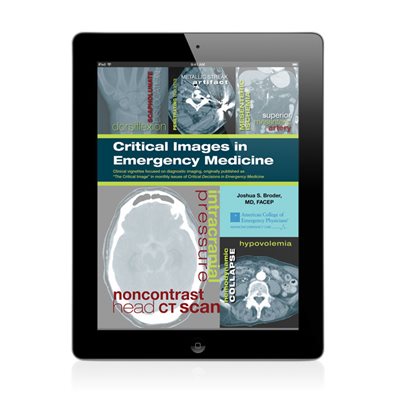 Critical Images in Emergency Medicine for iPad (APP Store)